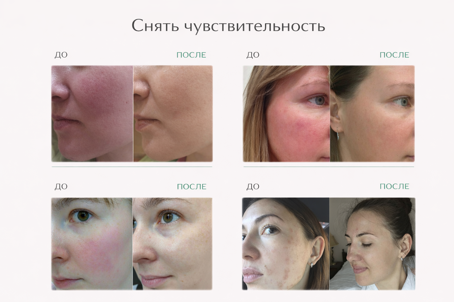 Снять чувствительность